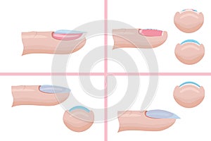 Hand nail care. The technique of applying the base layer of manicure, mistakes. Illustration for the manicure guide. Vector