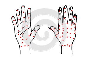 Hand palm and dorsal side sketch. Alternative medicine and treatment. Chinese red points acupuncture scheme drawing