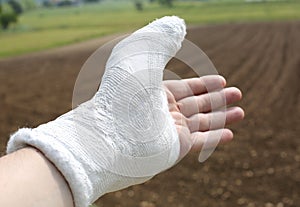 Hand plaster especially the thumb and an agricultural background