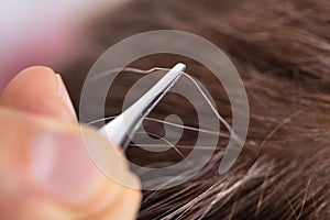 Hand Plucking Gray Hair With Tweezers