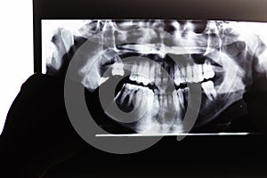 Hand pointing x-ray image