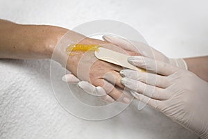 Hand procedure