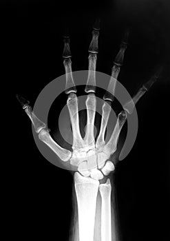 Hand radiograph