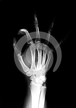 Hand radiograph