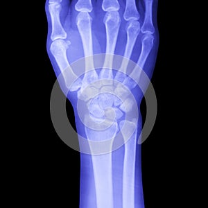 Hand x-ray view