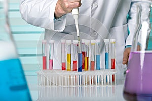 Hand of a researcher pipetting samples in tubes test