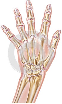 Hand - Rheumatoid Arthritis of the Joints