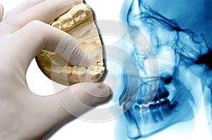 Hand show dental model over x-ray photo