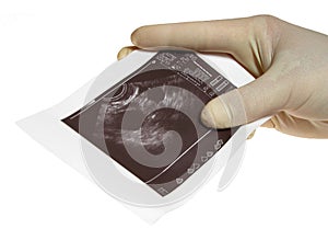 Hand with sonogram photo