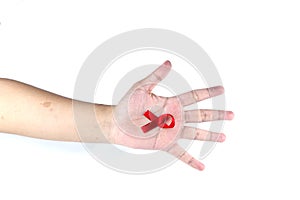hand symbol with red ribbon signifying concern for people with HIV aids isolated on white background