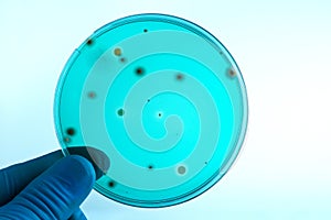 Hand of a technician holding green petri dish in laboratory