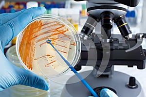 hand of technician holding plate with bacterial colonies of Streptococcus agalactiae and microscope in background photo