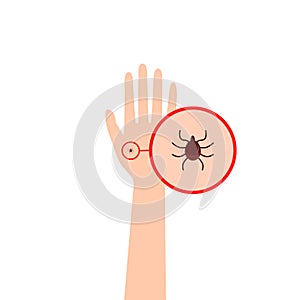 Hand with a tick under a magnifying glass