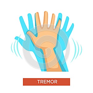 Hand tremor neurological disorder human body part
