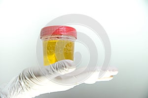 Hand with urine container