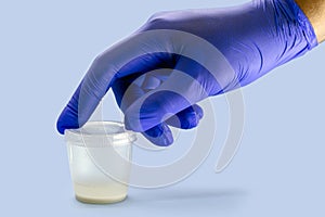Hand wearing nitrile glove holding semen or sperm sample collection container, semen donation concept
