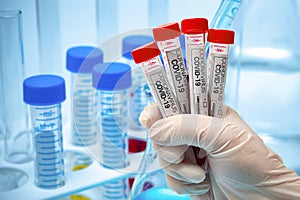 A hand wearing a white latex glove and holding a coronavirus test kit. Pandemic infectious concept