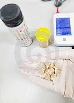 Hand in white glove holding bladder stones results in illness animal on laboratory room background.