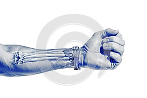 Hand wrist Pain - Studio shot with 3D illustration isolated on white