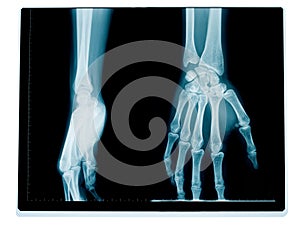 Hand and wrist radiography