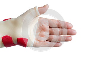 Hand with wrist and thumb splint