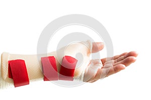 Hand with wrist and thumb splint