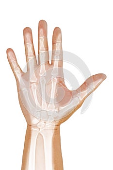 Hand , wrist x-ray lateral view ,Medical image concept on white background