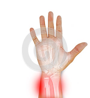 Hand , wrist x-ray view fracture distal ulna pain and swelling ,Medical image concept on white background photo
