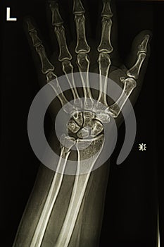 hand x-rays image
