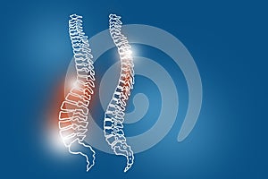Handrawn illustration of human Spine on dark blue background.