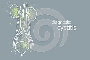 Handrawn medical poster of human kidneys organ with cystitis. Diseases of the genitourinary system.