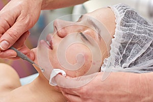 Hands of cosmetician, blackhead remover.