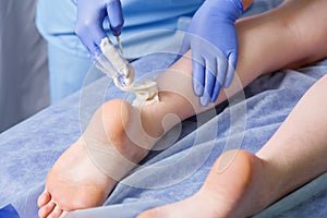 The hands of the doctor beautician makes a shugaring next to the heel of the left leg to a young woman