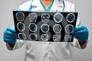 Hands of a doctor holding head mri scan