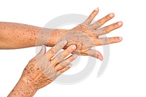 Hands full of freckles and wrinkles photo