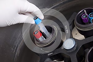 Hands in glove loading centrifuge
