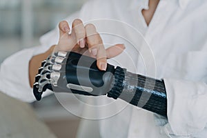 Hands of handicapped girl. Cyber prosthesis hand has processor chip, software and buttons