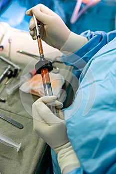 Hands Holding Syringe and Transfer Fat with Nano Fat Transfer Tool in Operation Room