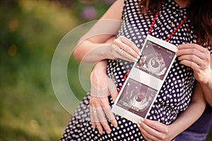 Hands of husband and wife on background of pregnant woman belly holding ultrasound with picture of their child