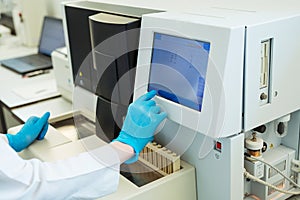 Hands of laboratory assistant loading sample tubes for coagulation test analysis and inputing data to coagulation