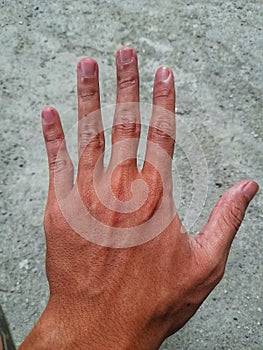 the hands of a manual labourer