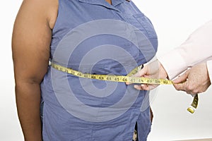 Hands Measuring Abdomen Of An Obese Woman