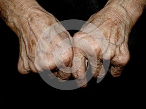 Hands of an old lady with traces of long life
