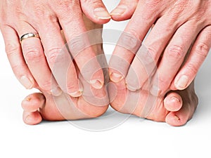 Hands pulling toes on barefoot feet