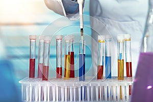 Hands of a researcher pipetting samples of fluids in tubes test