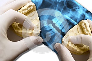 Hands show molar teeth over x-ray dental scan