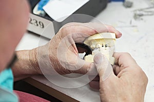 Hands of technician working on 3D printed mold for dental implants