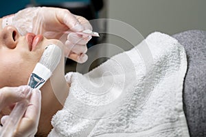 hands in white gloves applies white moisturizing cream on a patient`s face for skin care