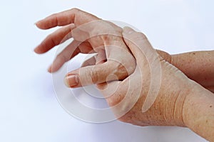 The hands of a woman with Parkinson`s disease tremble very strongly