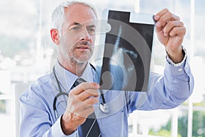 Handsome doctor examining an x-ray